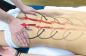Preview: Videofilm Breuß-Massage Demonstrationsvideo - e-download